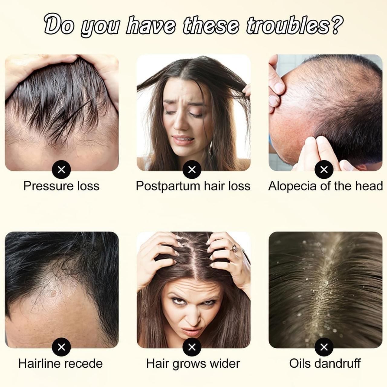 Gingerra™️Ginger Extract Anti-Hairfall Shampoo (Pack of 3)